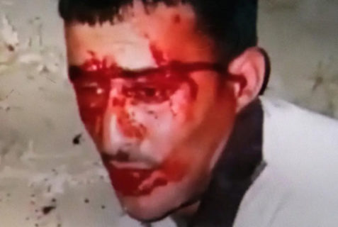 Le visage de Majdi Ikhtat, victime d'une agression policière,dans une vidéo prise par ses assaillants - Image via Haaretz