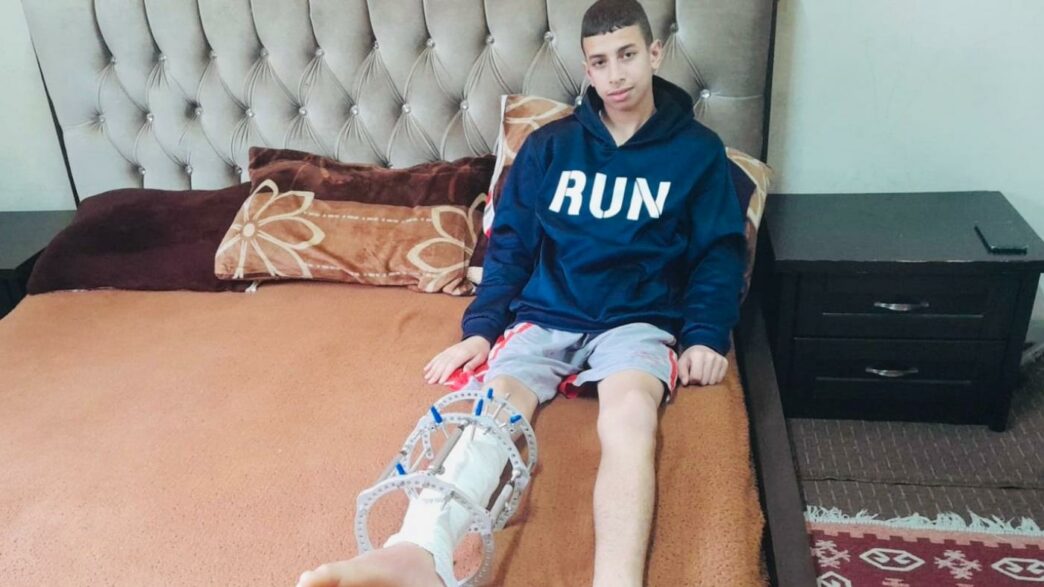 Enfants palestiniens emprisonnés : Amir Al-Biss, 13 ans, est cloué au lit après s’être fait tirer deux balles dans la jambe droite par des soldats israéliens au nord de Hébron, le 4 mars 2023. 