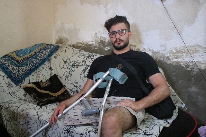 Les balles d’Israël laissent des blessures inguérissables : À cause d’une infection bactérienne tenace dans ce qui reste de la jambe de Muhammad Hussein, il est impossible de lui adapter la moindre prothèse. 