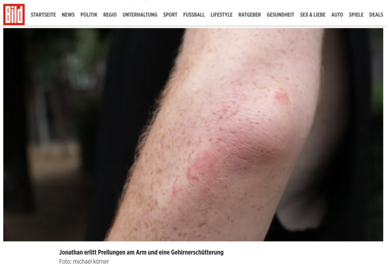Une photo publiée par le journal allemand Bild montre les blessures subies par l'Israélien Yonatan Yisraeli. (Photo : Bild)