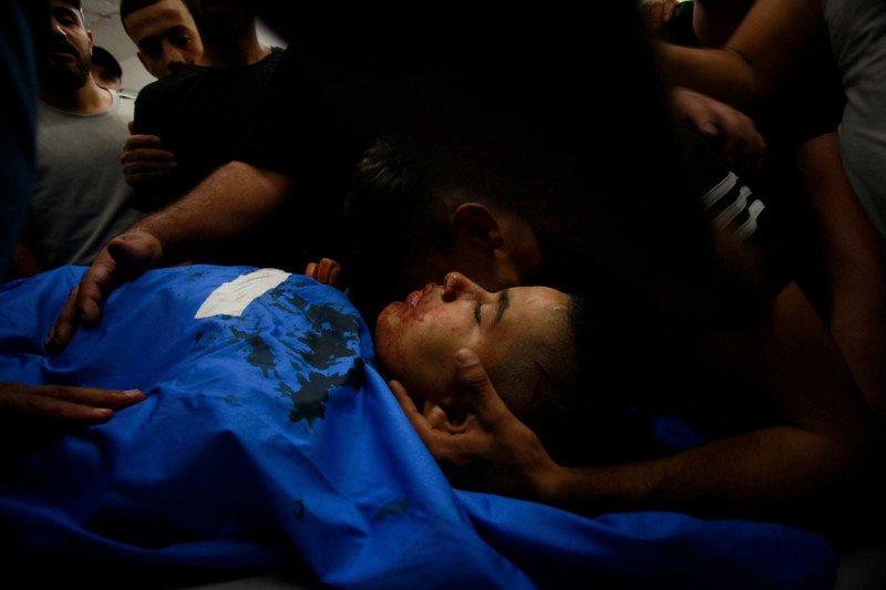 19 octobre 2023. Hospitalisation d’un gamin palestinien blessé lors d’un raid de l’armée israélienne dans le camp de réfugiés de Nur Shams, à Tulkarem en Cisjordanie occupée