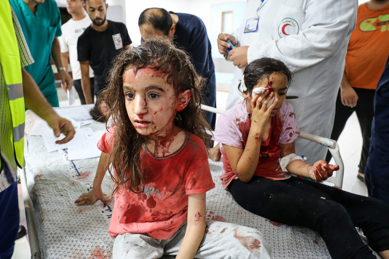 9 octobre 2023. Des enfants blessés en traitement à l’hôpital al-Shifa de Gaza