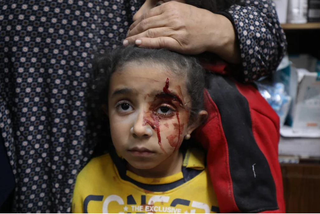 20 février 2024. Une fillette blessée attend d’être soignée à l’hôpital des Martyrs d’Al-Aqsa, suite à une attaque israélienne contre Deir al-Balah, dans la partie centrale de Gaza. 
