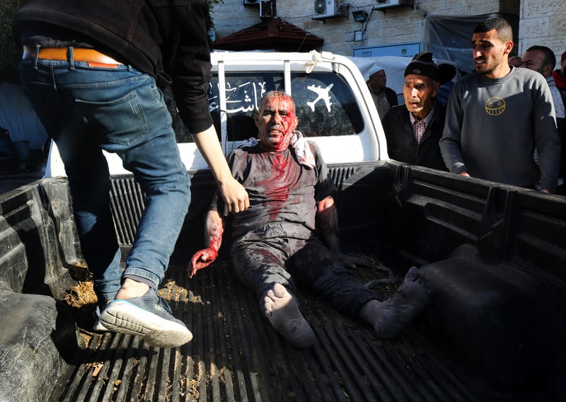 L'Afrique du Sud accuse Israël de mépris envers l'ordre de la Cour internationale. Photo :  Un Palestinien blessé est emmené vers l'hôpital des Martyrs d'Al-Aqsa, à Deir al-Balah, dans la partie centrale de Gaza, suite aux attaques israéliennes du 8 mars 2024. 