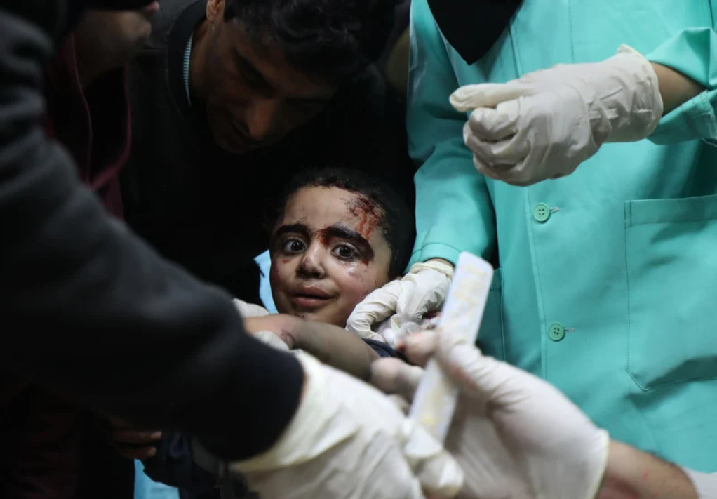 Gaza, 7 Mars 2024. Un enfant blessé est soigné par des médecins à l'hôpital des Martyrs d'Al-Aqsa, à Deir El-Balah, suite à des attaques israéliennes. 