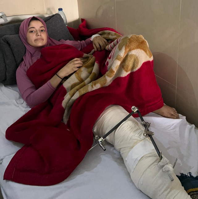 Un des survivants du massacre, Aida Abu Nasr, 15 ans, à l'hôpital al-Helou de Gaza. 