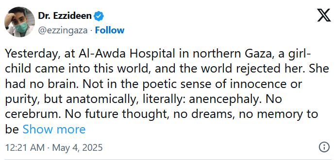 « Hier, à l'hôpital Al-Awda, dans le nord de Gaza, une fille est venue au monde et le monde l'a rejetée. Elle n'avait pas de cerveau. Non pas dans le sens poétique de l'innocence ou de la pureté, mais anatomiquement, littéralement : anencéphalie. Pas de cerveau, pas de vision du futur, pas de rêves, pas de souvenirs à engranger... »
