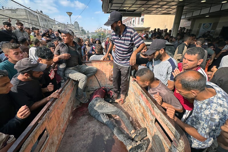 Les Palestiniens forcés de choisir : se faire tuer ou mourir de faim, dit l'ONU. Photo : 17 juin. Des victimes sont transférées au Complexe médical Nasser après que l'armée israélienne a attaqué les gens qui attendaient de l'aide alimentaire à Khan Younis, dans le sud de Gaza. (Photo : Moaz Abu Taha / APA images)