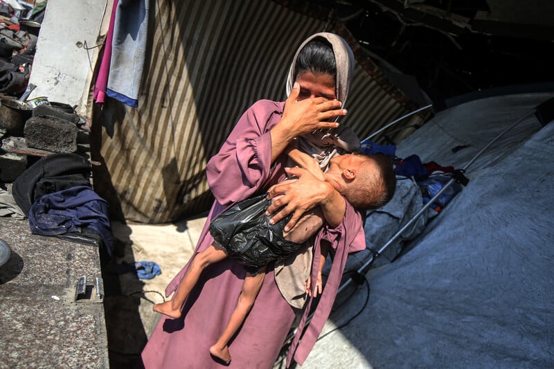 Photo : Un enfant en bas âge en train de mourir de faim à Gaza, ce 24 juillet.