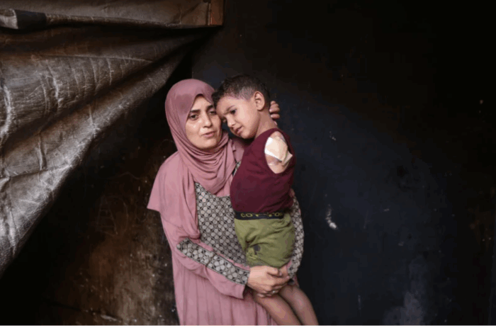 Israël cible des journalistes et des sauveteurs lors d'une double frappe contre un hôpital de Gaza. Photo : Une mère porte sur le bras son enfant mutilé de 3 ans, Ahmad, à l'intérieur de leur tente abri à Gaza, le 24 août. (Photo : Omar Ashtawy / APA Images)