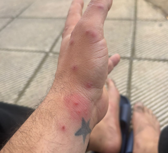 Mohammed Khatib et des effets des conditions sanitaires régnant dans les prisons grecques